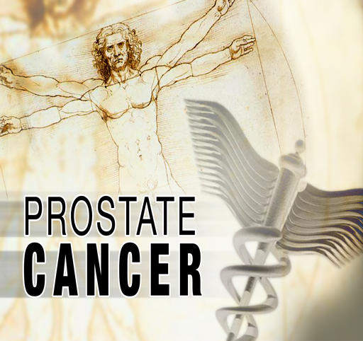 prostate cancer