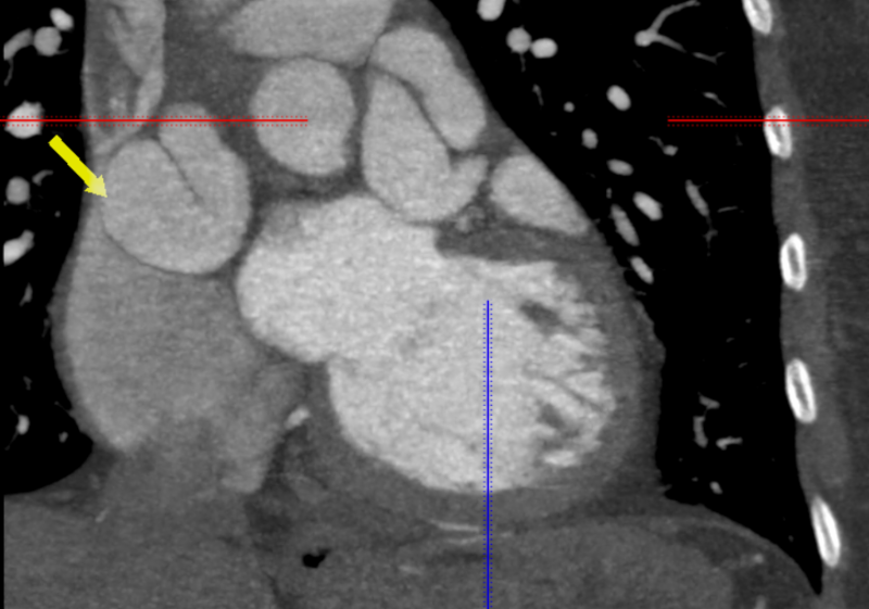 Multi Disciplinary Team Discussion