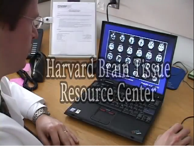 Harvard Brain Tissue Bank