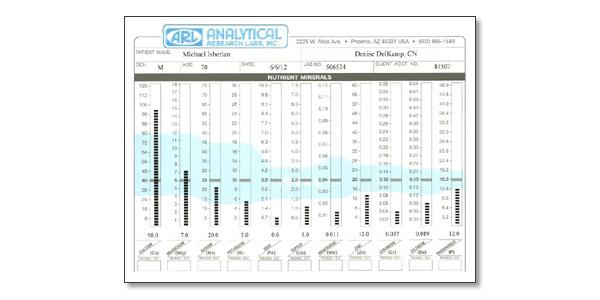 hair tissue mineral analysis HTMA