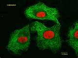 Cancer cells