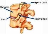 Diagram of 2 vertebrae and a disk