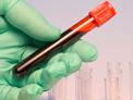Blood sample vial in gloved hand